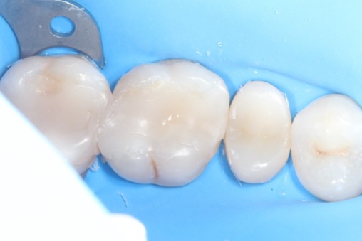 Before image