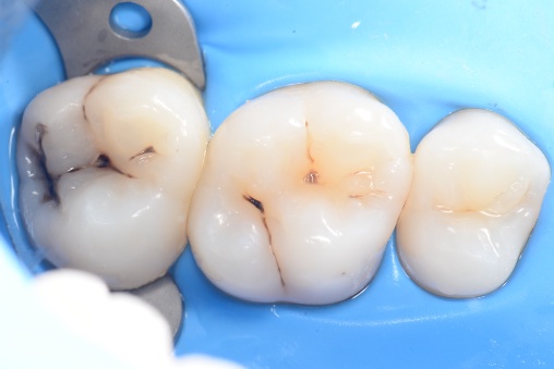Before image