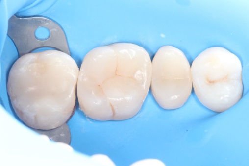 After image